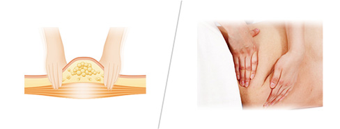 {スッキボディリ、リフレッシュボディ}