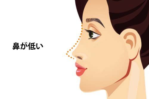 鼻が低い