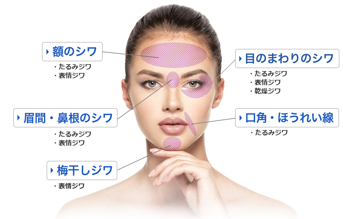 お顔のシワ対策